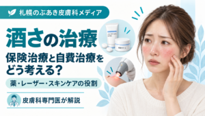 酒さの保険治療と自費治療、薬・レーザー・スキンケアの役割を解説する記事のアイキャッチ画像