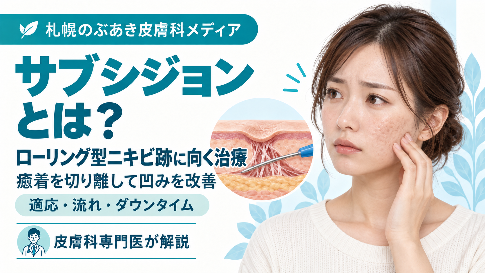 ローリング型ニキビ跡に対するサブシジョンの適応・流れ・ダウンタイムを解説する記事のアイキャッチ画像
