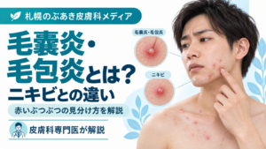 毛嚢炎・毛包炎とニキビの違い、赤いぶつぶつの見分け方を解説する記事のアイキャッチ画像