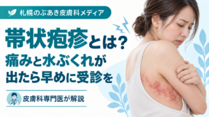 帯状疱疹の痛みと水ぶくれ、早めの受診の重要性を解説する記事のアイキャッチ画像