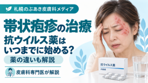 帯状疱疹の抗ウイルス薬をいつまでに始めるか、薬の違いを解説する記事のアイキャッチ画像