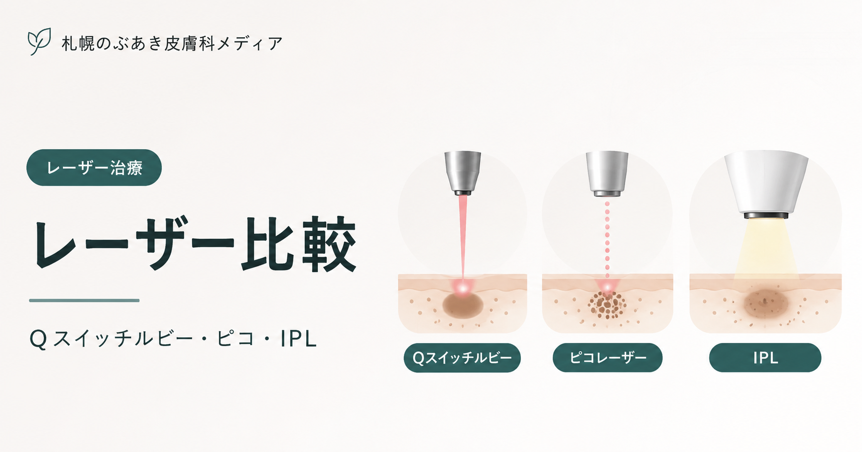 Qスイッチルビー・ピコレーザー・IPLの比較