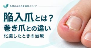 陥入爪と巻き爪の違い・化膿したときの治療