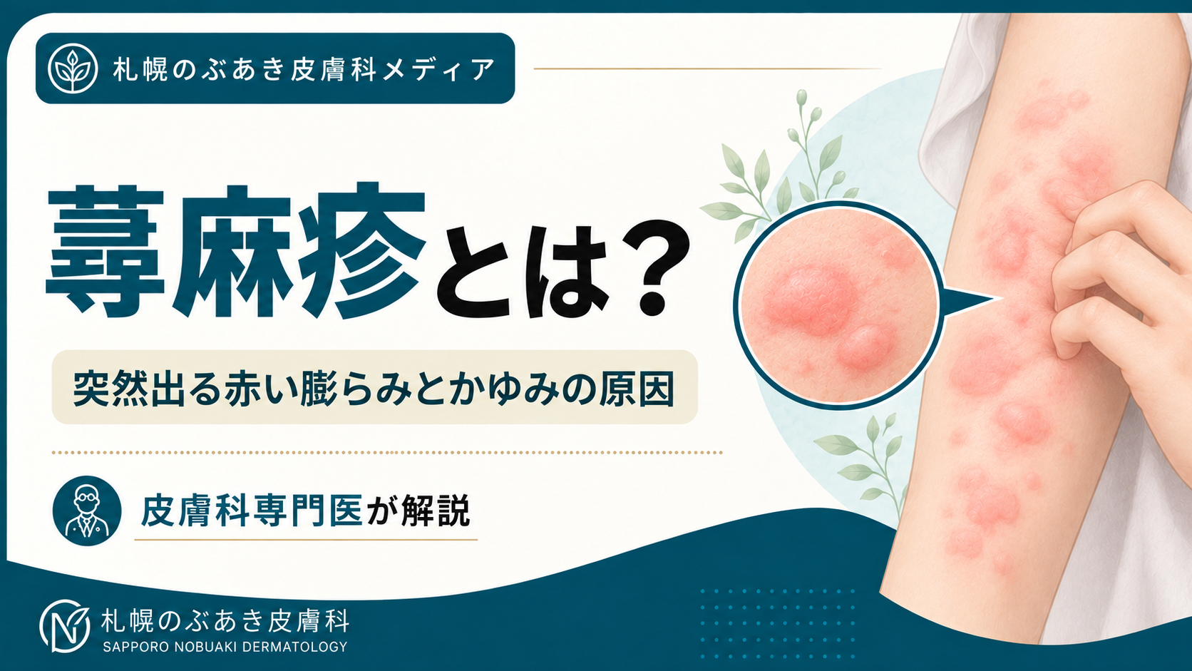 前腕に赤く盛り上がった蕁麻疹の膨疹と、その拡大イラスト