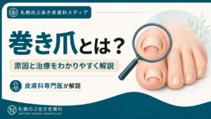 足の親指の爪が両側から内側へ湾曲した巻き爪と拡大イラスト