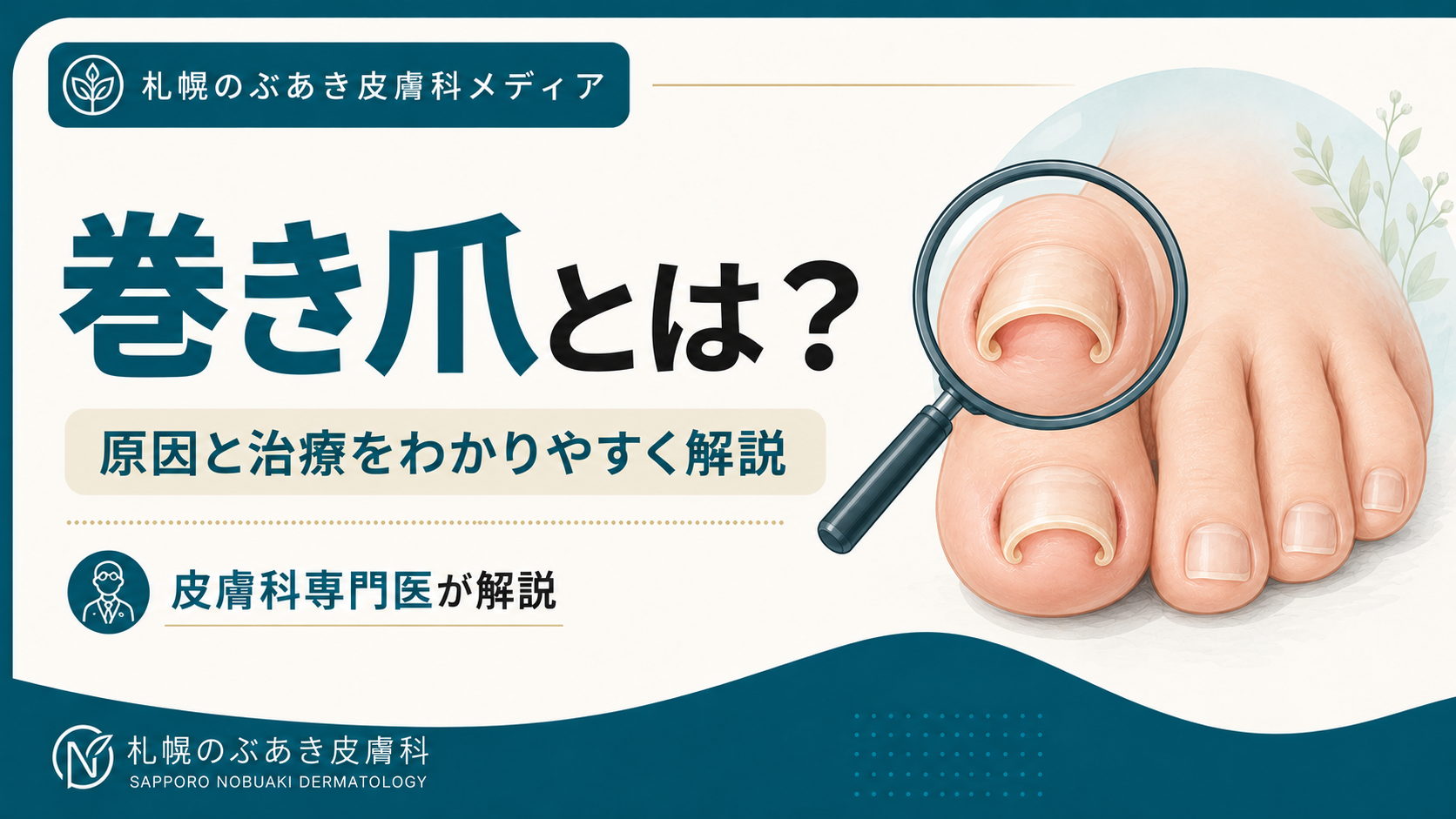 足の親指の爪が両側から内側へ湾曲した巻き爪と拡大イラスト