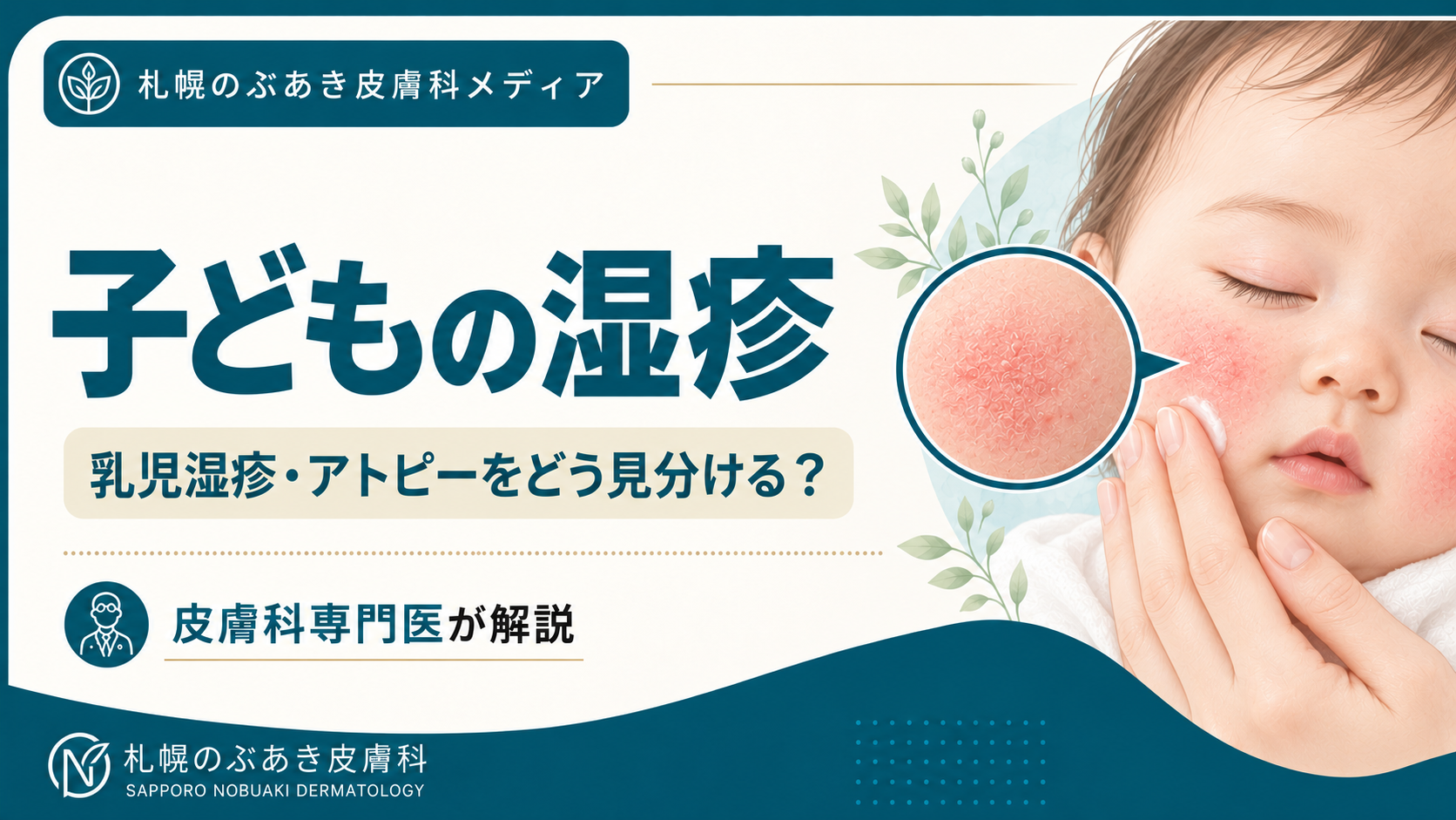 頬に赤みと乾燥のある赤ちゃんと、保護者が肌をケアするイラスト
