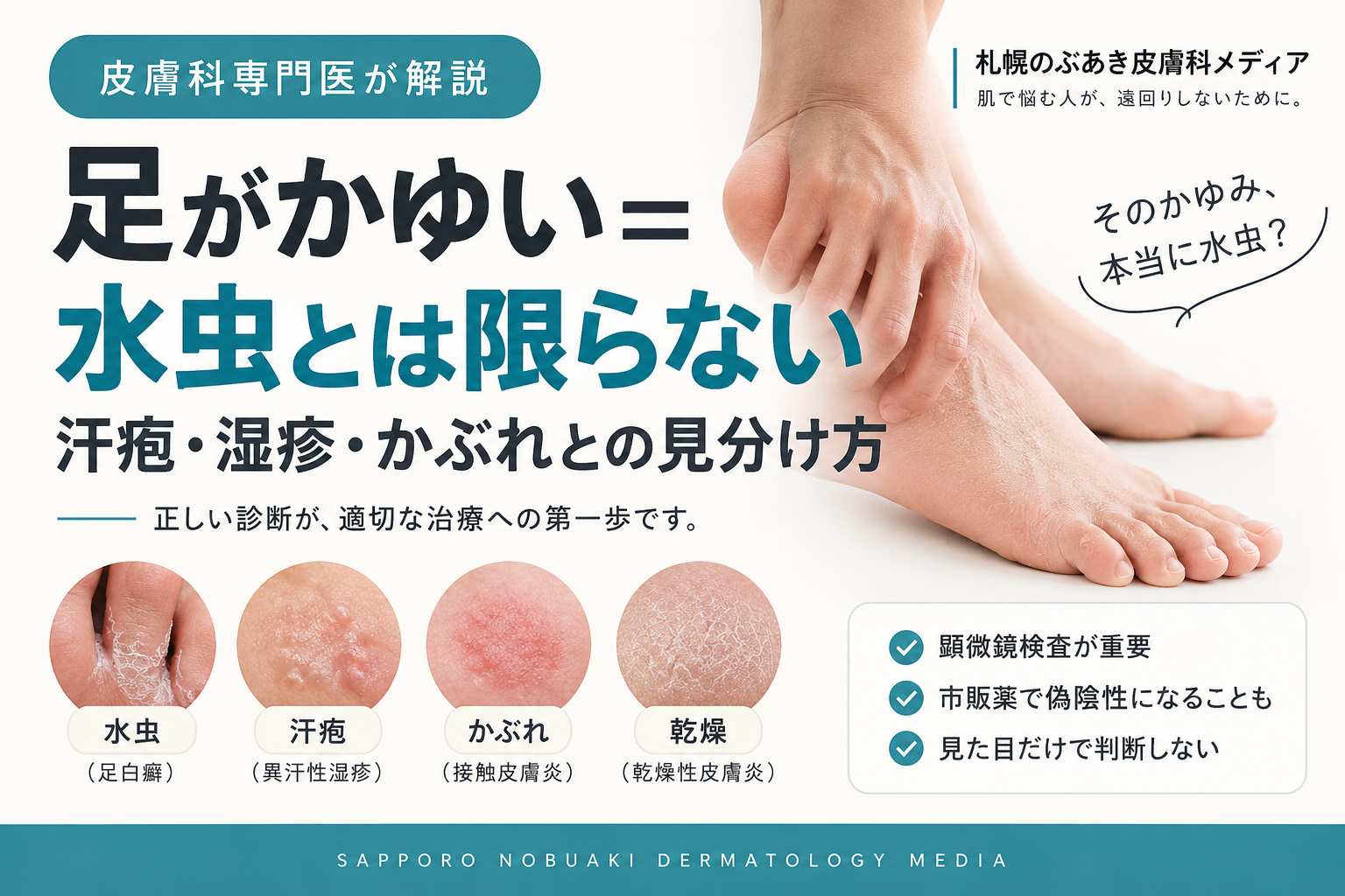 足がかゆい＝水虫とは限らない。汗疱・湿疹・かぶれとの見分け方を解説する記事のアイキャッチ画像