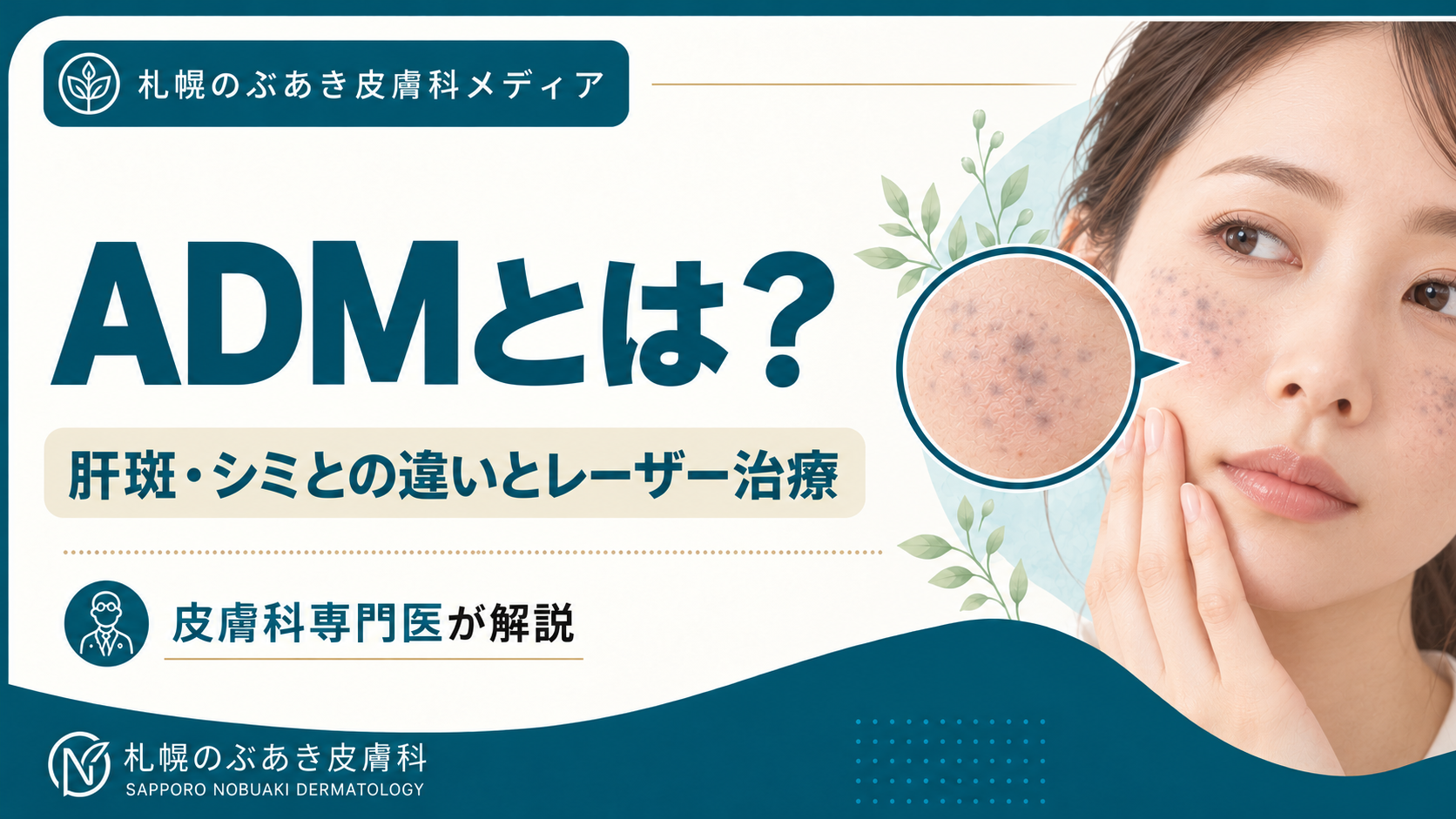 ADM（後天性真皮メラノサイトーシス）とは？肝斑・シミとの違いとレーザー治療