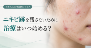 ニキビ跡を残さないために治療を始めるタイミング
