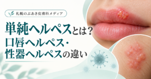 単純ヘルペスとは？口唇ヘルペス・性器ヘルペスの違い