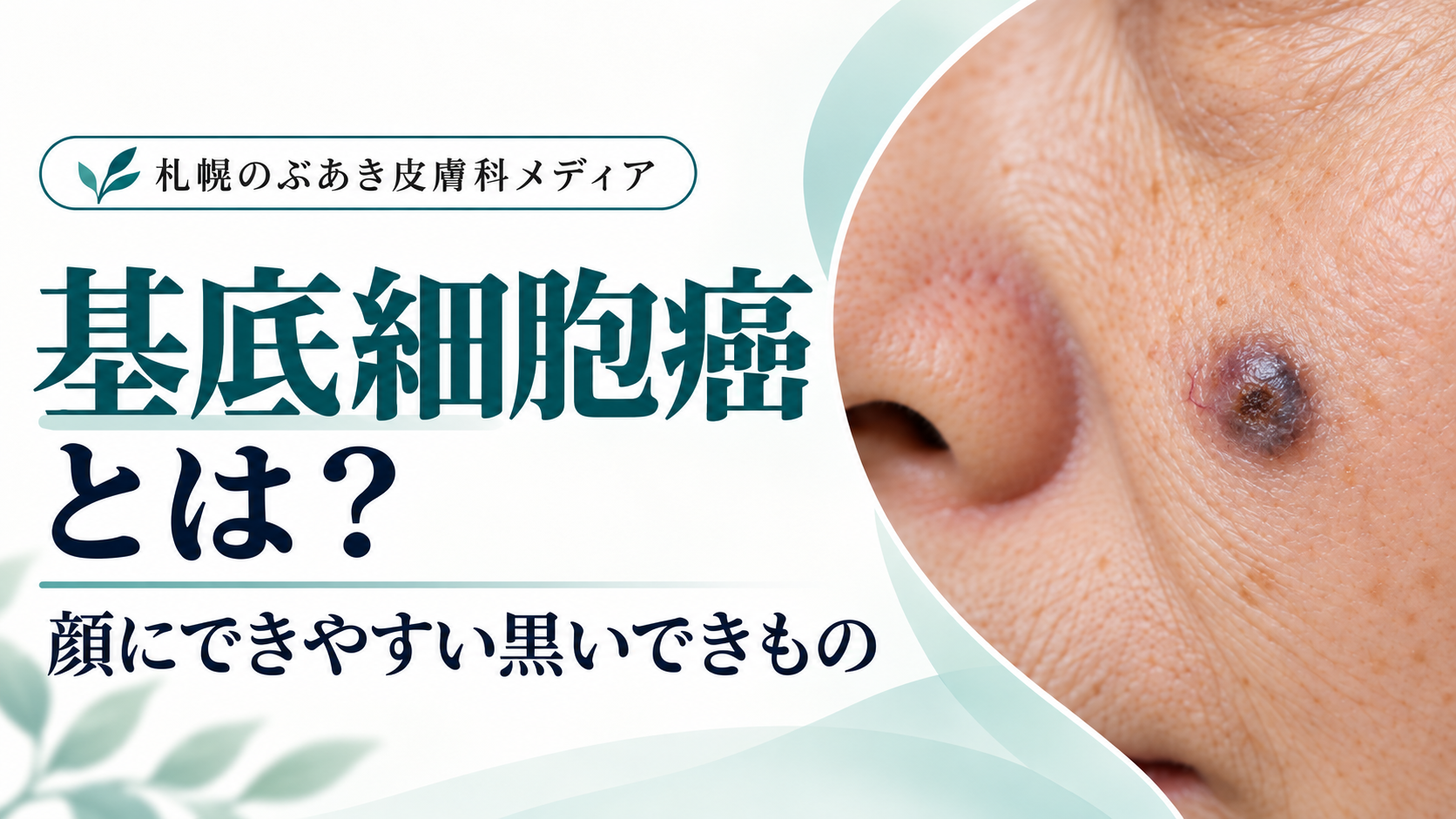 基底細胞癌とは?顔にできやすい黒いできもの