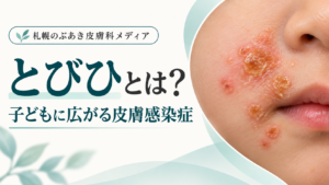 とびひ（伝染性膿痂疹）とは？子どもに広がる皮膚感染症