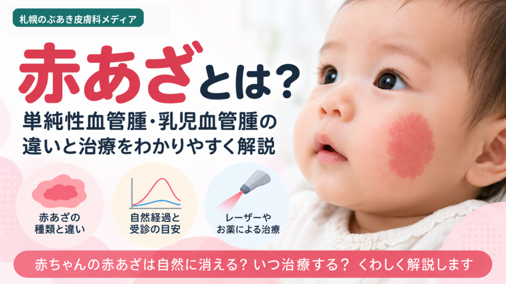 赤あざとは？単純性血管腫・乳児血管腫の違いと治療