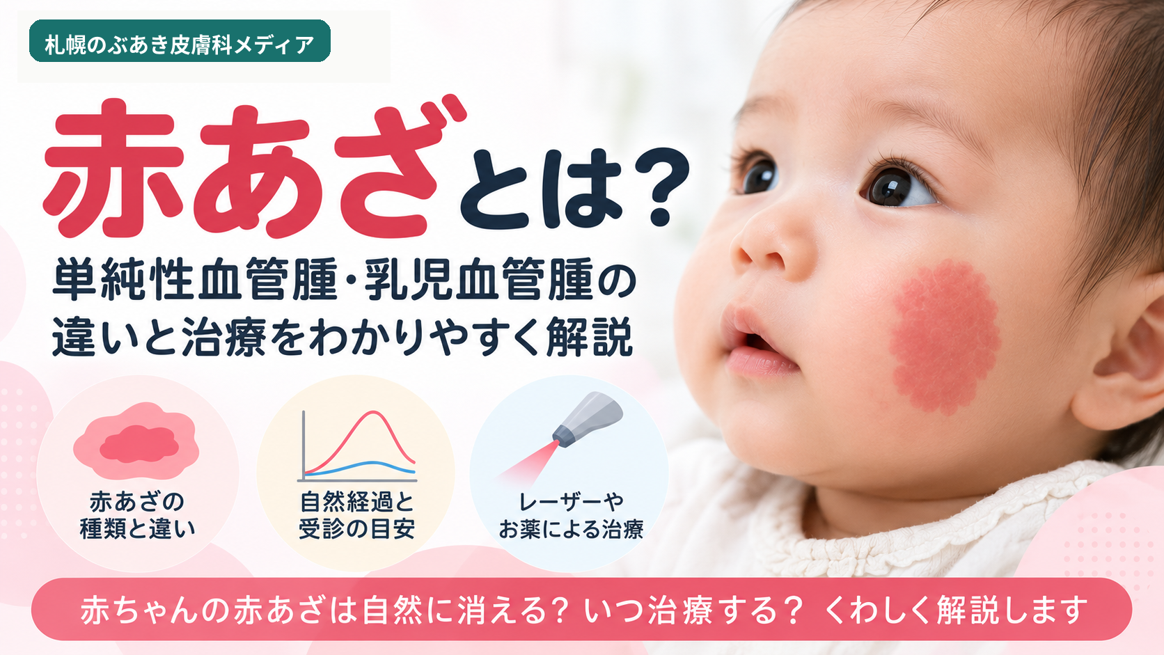 赤あざとは?単純性血管腫・乳児血管腫の違いと治療