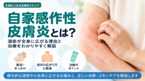 自家感作性皮膚炎とは？湿疹が全身に広がる理由と治療