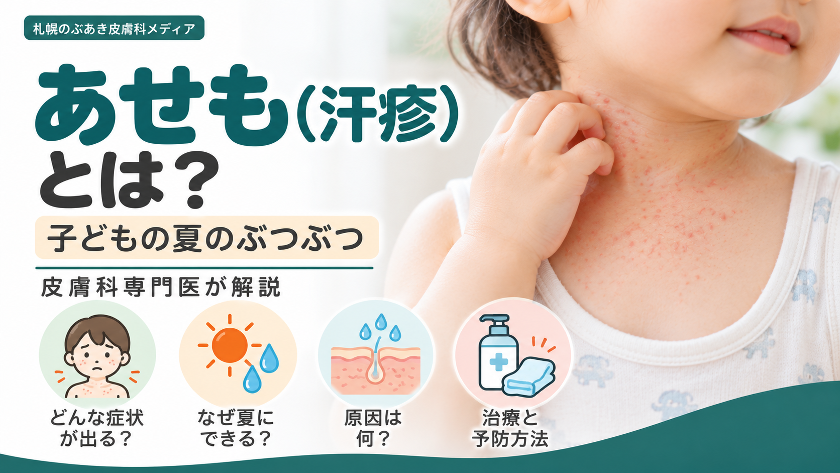 あせも(汗疹)とは?子どもの夏のぶつぶつ