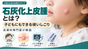 石灰化上皮腫とは？子どもにもできる硬いしこり