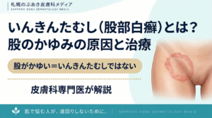 いんきんたむし（股部白癬）とは？股のかゆみの原因と治療