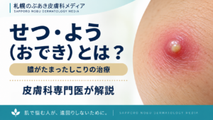 せつ・よう（おでき）とは？膿がたまったしこりの治療