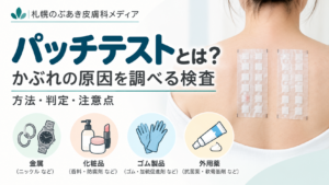 パッチテストとは？かぶれの原因を調べる検査の方法・判定・注意点