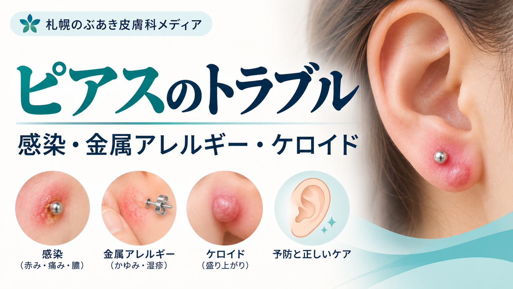 ピアスの感染・金属アレルギー・ケロイドを解説するアイキャッチ