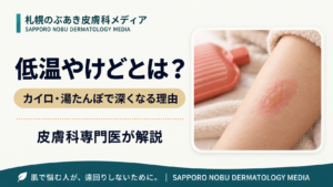 低温やけどとは？カイロ・湯たんぽで見た目より深くなる理由と治療