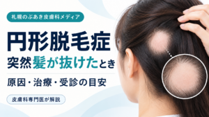 円形脱毛症の原因・治療・受診の目安を解説する記事のアイキャッチ画像