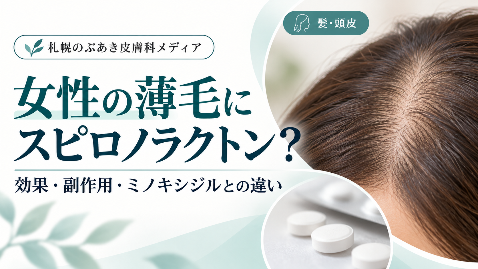 女性の薄毛にスピロノラクトン|効果・副作用・ミノキシジルとの違い