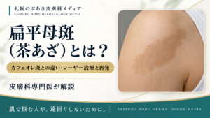 扁平母斑（茶あざ）のレーザー治療と再発を解説するアイキャッチ画像
