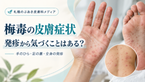梅毒の皮膚症状を解説するアイキャッチ画像。手のひら・足の裏・全身の発疹を示した医療イメージ