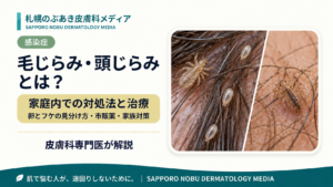 頭じらみと毛じらみの虫体や卵、家庭内での対処法を解説するアイキャッチ画像