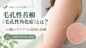 二の腕の毛孔性苔癬（毛孔性角化症）の細かいブツブツを示すアイキャッチ画像