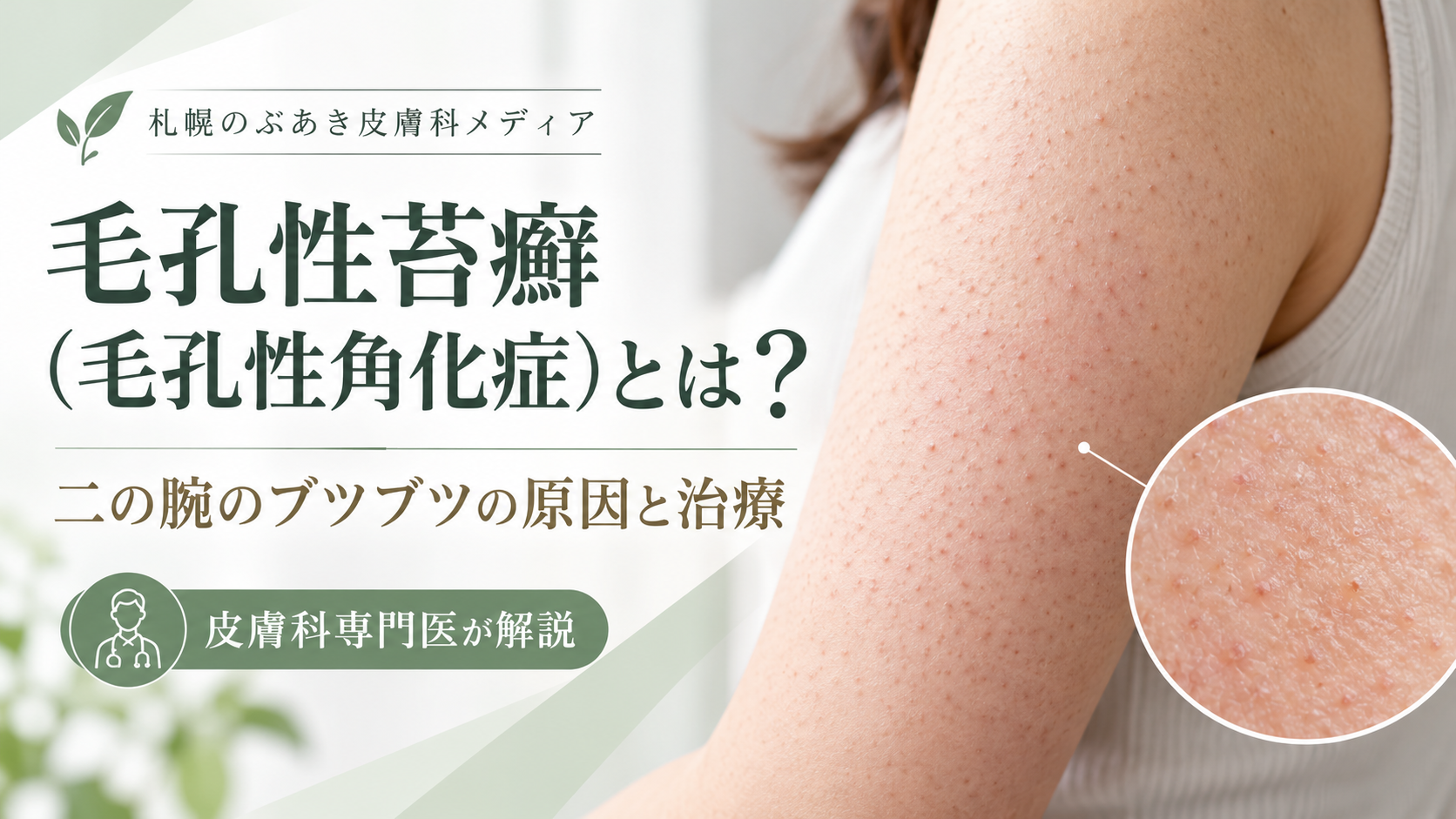 二の腕の毛孔性苔癬（毛孔性角化症）の細かいブツブツを示すアイキャッチ画像