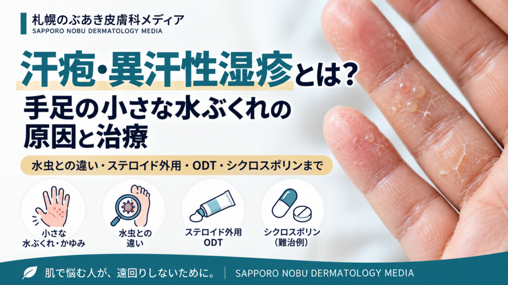 汗疱・異汗性湿疹とは？手足の小さな水ぶくれの原因と治療