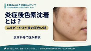 炎症後色素沈着（PIH）の原因とニキビ・やけど後の茶色い跡を解説するアイキャッチ画像