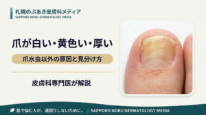 爪が白い・黄色い・厚い｜爪水虫以外の原因と見分け方