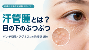 汗管腫の特徴とパンチ切除・アグネスなどの治療選択肢を解説する記事のアイキャッチ画像