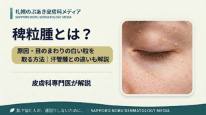 目のまわりの稗粒腫と汗管腫との違いを解説するアイキャッチ画像