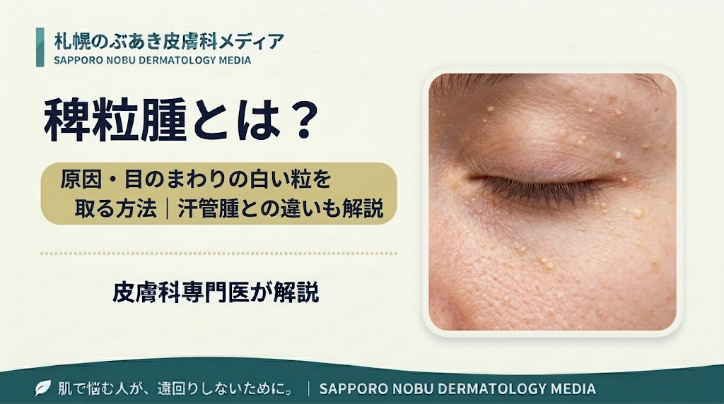 目のまわりの稗粒腫と汗管腫との違いを解説するアイキャッチ画像