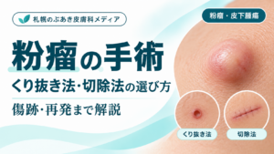 粉瘤の手術｜くり抜き法と切除法の選び方・傷跡・再発