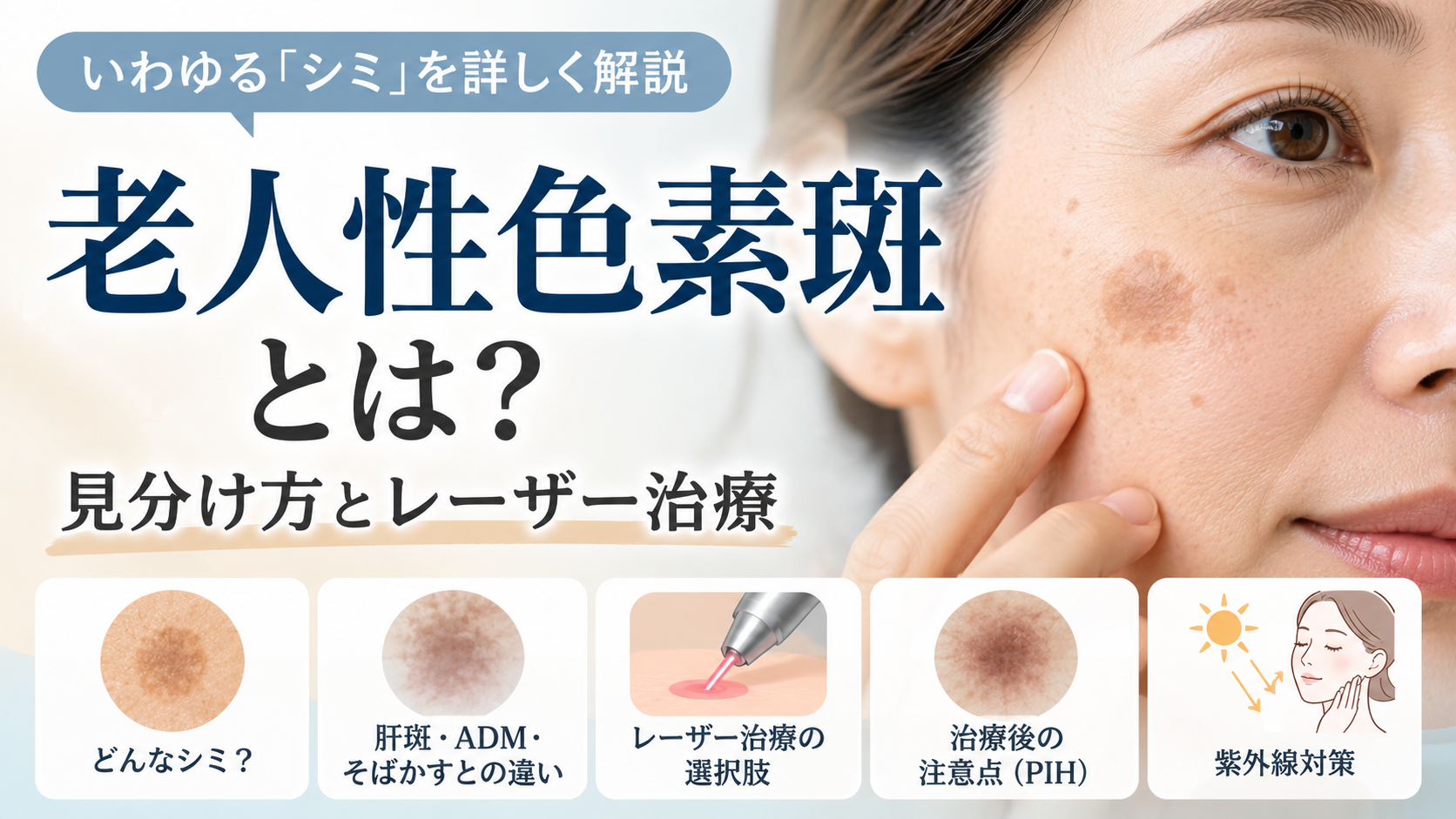 老人性色素斑とは？いわゆるシミの見分け方とレーザー治療