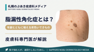 脂漏性角化症とは？老人性いぼの見分け方と治療