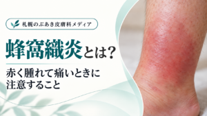 蜂窩織炎とは？赤く腫れて痛いときに注意すること