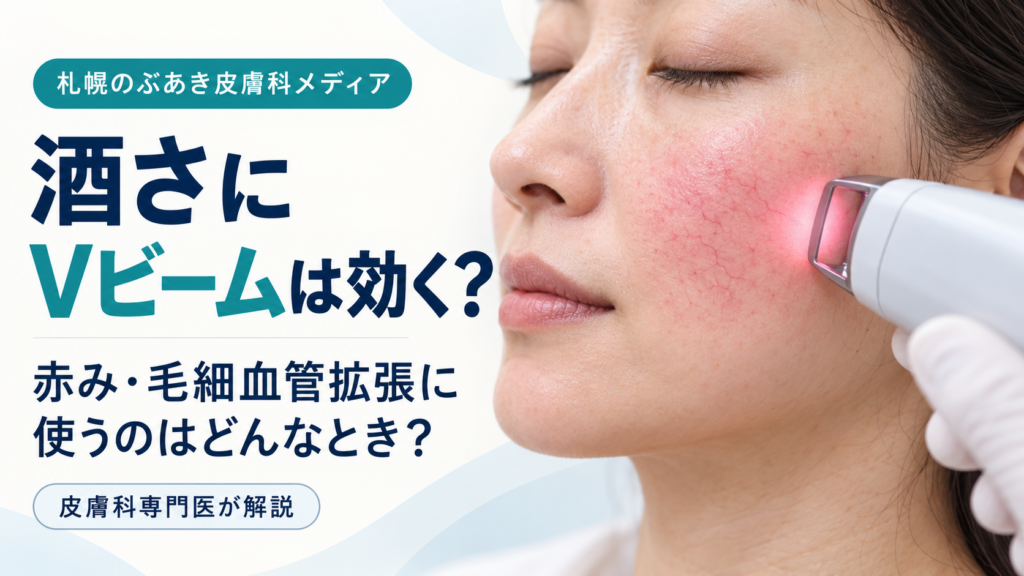 酒さの赤み・毛細血管拡張にVビームを使うタイミングを解説する記事のアイキャッチ画像