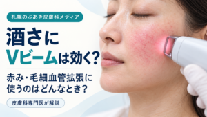 酒さの赤み・毛細血管拡張にVビームを使うタイミングを解説する記事のアイキャッチ画像