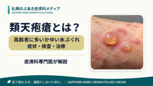 類天疱瘡の緊満性水疱と高齢者のかゆみを解説するアイキャッチ画像