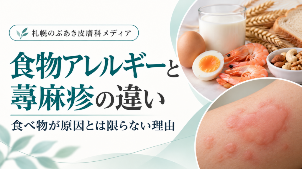 食物アレルギーと蕁麻疹の違い｜食べ物が原因とは限らない理由