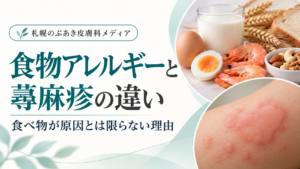食物アレルギーと蕁麻疹の違い｜食べ物が原因とは限らない理由