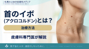 首のイボ（アクロコルドン）とは？原因と治療方法